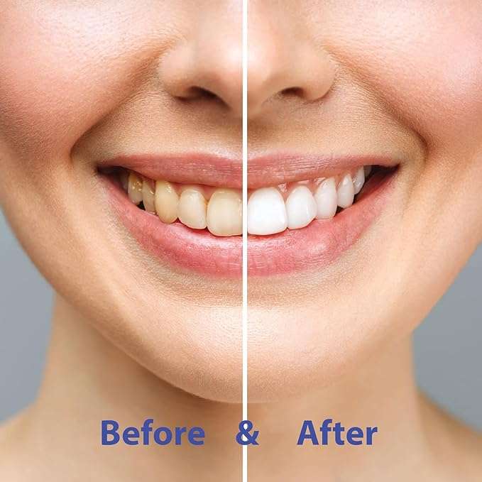 CHOMP Super Whitening Spearmint NHAP Toothpaste Tablets