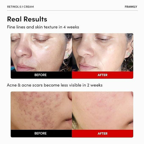 BestBy12/26 FRANKLY Retinol 0.1% Cream 1.01oz Night Anti-Aging Korean Skin Care